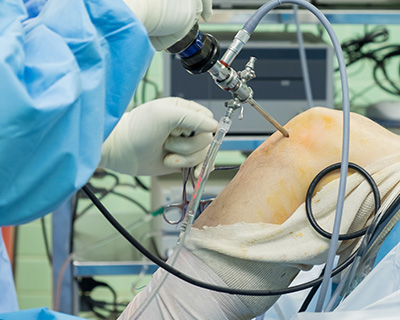 半月板内視鏡手術