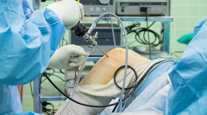 半月板内視鏡手術